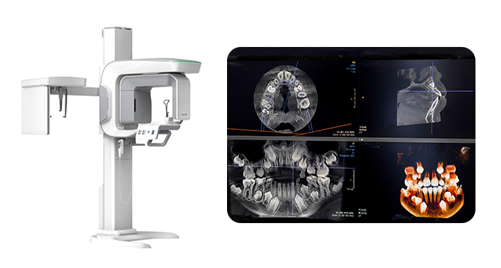 3D CT